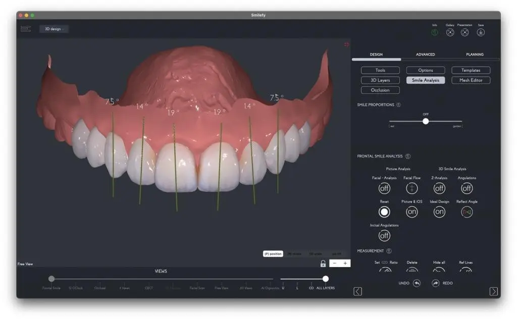 Digital Smile Simulation: كيف تتخيل ابتسامتك قبل بدء العلاج؟