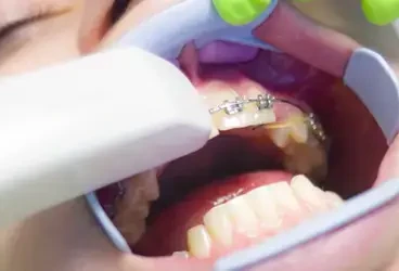 التقويم المعدني للكبار هل هو مناسب في 2025؟ [دليل شامل]