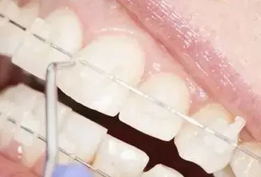 أسرار مقاومة البقع في التقويم الخزفي: كيف يحافظ على بياضه الناصع؟