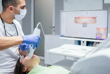 المسح ثلاثي الأبعاد في تقويم الاسنان : لماذا هو أفضل من الطبعات التقليدية