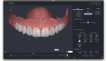 Digital Smile Simulation: كيف تتخيل ابتسامتك قبل بدء العلاج؟