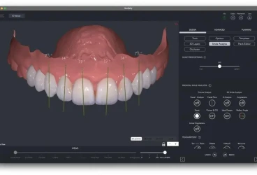 Digital Smile Simulation: كيف تتخيل ابتسامتك قبل بدء العلاج؟