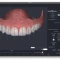 Digital Smile Simulation: كيف تتخيل ابتسامتك قبل بدء العلاج؟
