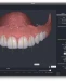 Digital Smile Simulation: كيف تتخيل ابتسامتك قبل بدء العلاج؟