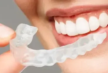 لماذا يُعد التقويم الشفاف الخيار الأمثل لتصحيح الأسنان؟